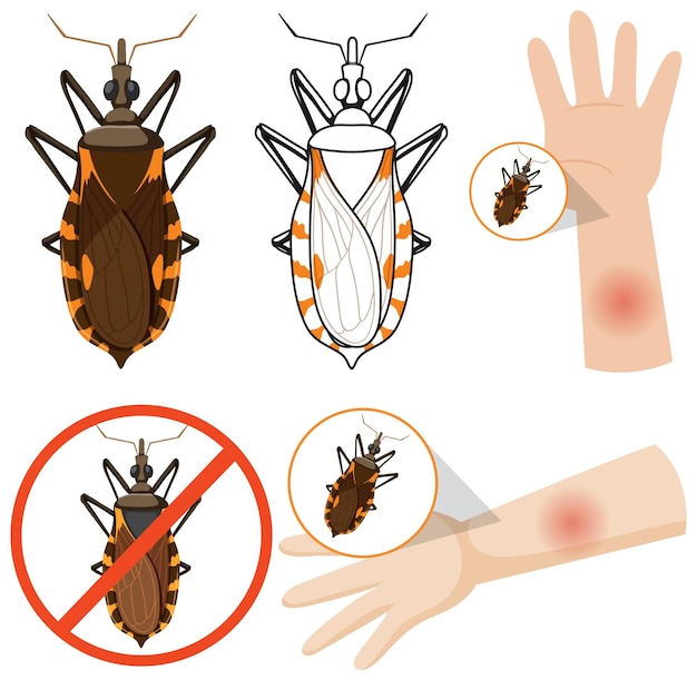 Gratis vector menselijke arm gezwollen door kussende insectenbeet