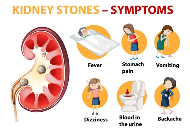 Nierstenen symptomen cartoon stijl infographic