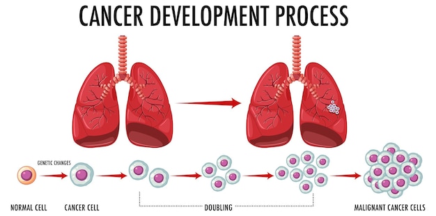 Proces van kankerontwikkeling infographic