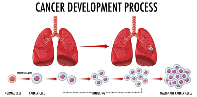 Proces van kankerontwikkeling infographic