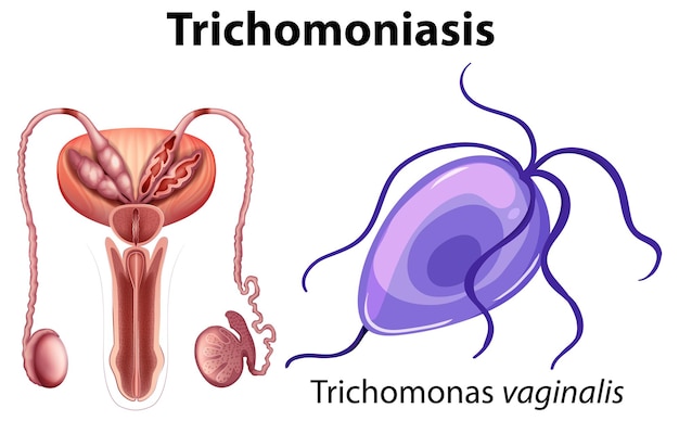 Trichomonas vaginalis op witte achtergrond